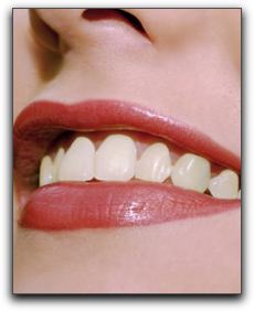 Porcelain Veneer Treatment Knoxville TN - Repair Broken Tooth