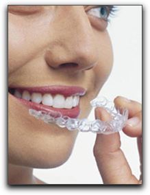 Clear Braces - Nearly Invisible Teeth Straightening for Knoxville Adults