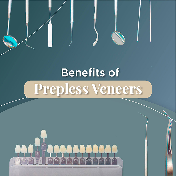 prepless porcelain veneers for crooked teeth correction
